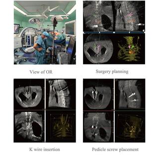 Surgical Navigation System PL300B image 14