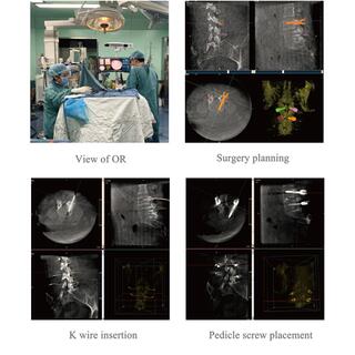 Surgical Navigation System PL300B image 15