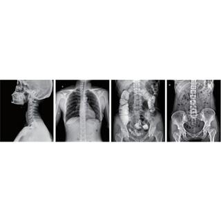 Dynamic FPD Digital Radiography & Fluoroscopy System PLD9600 Series image 3