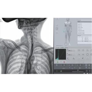 Dynamic FPD Digital Radiography & Fluoroscopy System PLD9600 Series image 23