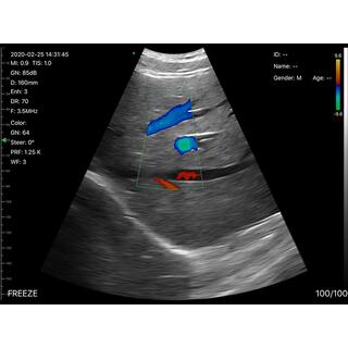 5CPL 3 in 1 Palm Doppler Ultrasound image 9