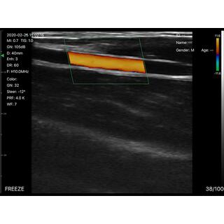 5CPL 3 in 1 Palm Doppler Ultrasound image 12