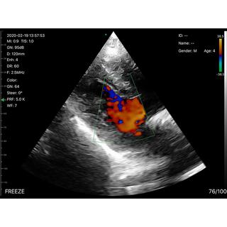 5CPL 3 in 1 Palm Doppler Ultrasound image 14