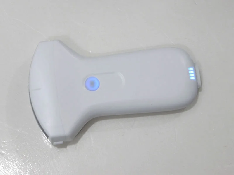 USB/wifi dual connect mode wireless ultrasound scanner