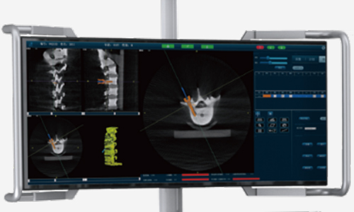 Surgical Navigation System PL300B image 4