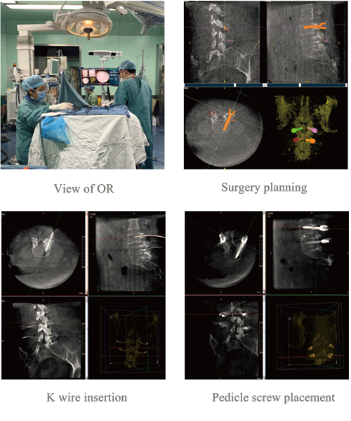 Surgical Navigation System PL300B image 15