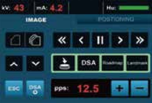 HF Mobile Digital C-arm System (Flat Panel Detector) PLX 7100A image 12