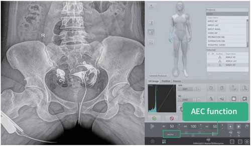 Dynamic FPD Digital Radiography & Fluoroscopy System PLD9600 Series image 20