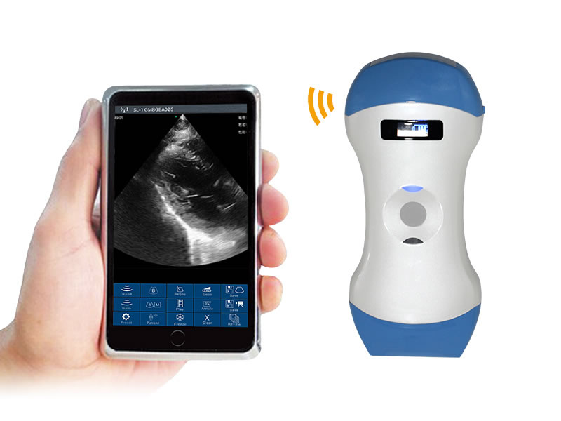 5CPL 3 in 1 Palm Doppler Ultrasound image 1