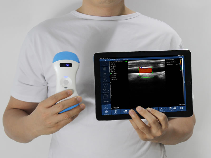 5CPL 3 in 1 Palm Doppler Ultrasound image 4