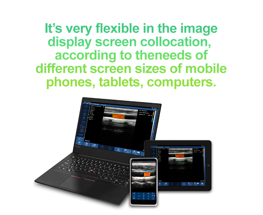 5CPL 3 in 1 Palm Doppler Ultrasound image 8