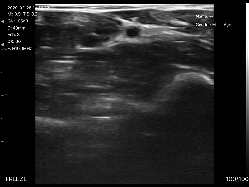 5CPL 3 in 1 Palm Doppler Ultrasound image 11