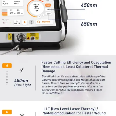 Mercury Soft Tissue Dental Laser